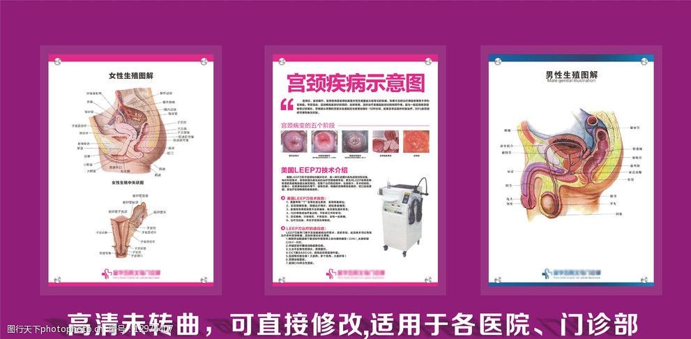 生殖器图解男女生殖器图解宫颈图解图片